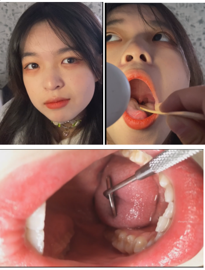 美女口腔检查ASMR特辑：2V声控福利带你探索咽喉健康护理[2V/1.24G]